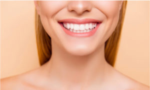 dental implants results